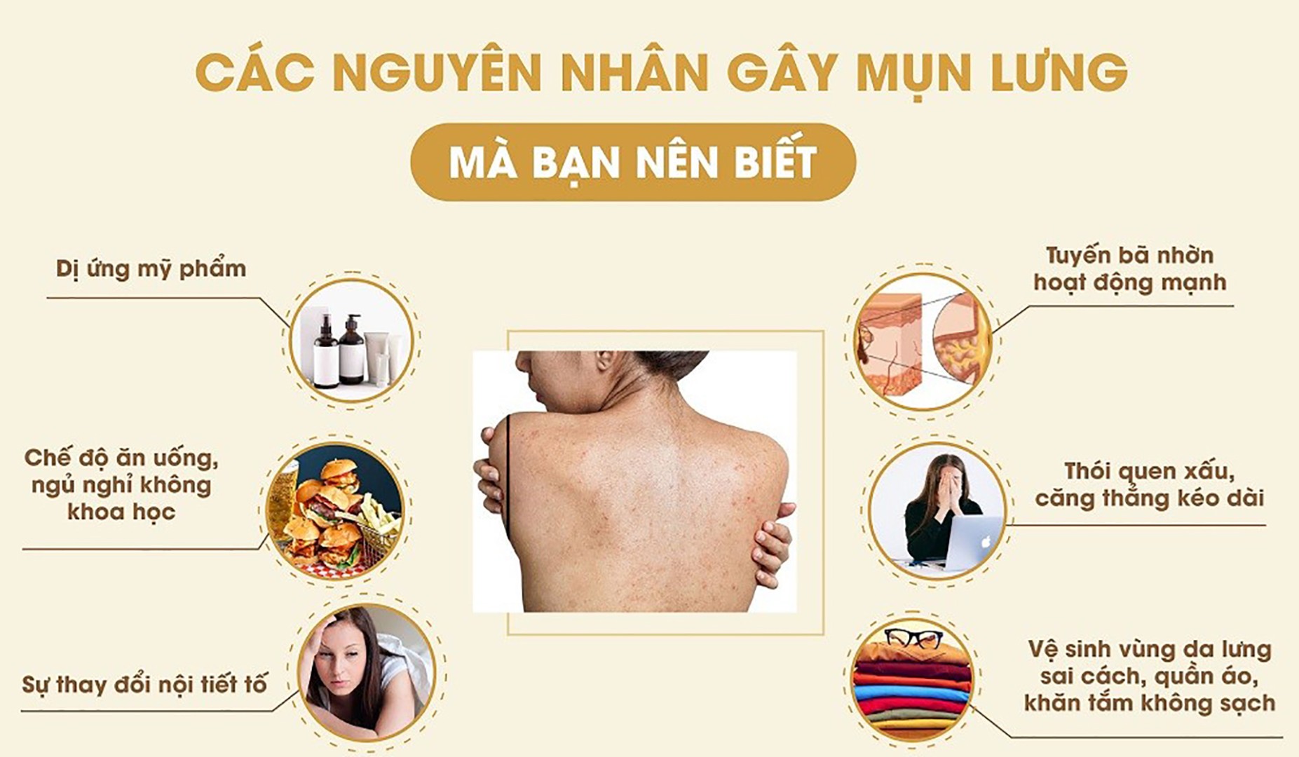 Nguyen Nhan Gay Ra Mun Lung