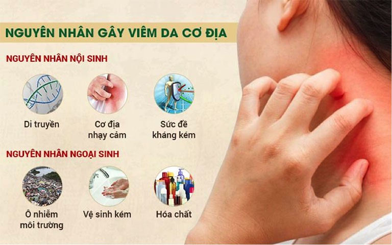 Nguyen Nhan Gay Viem Da Co Dia