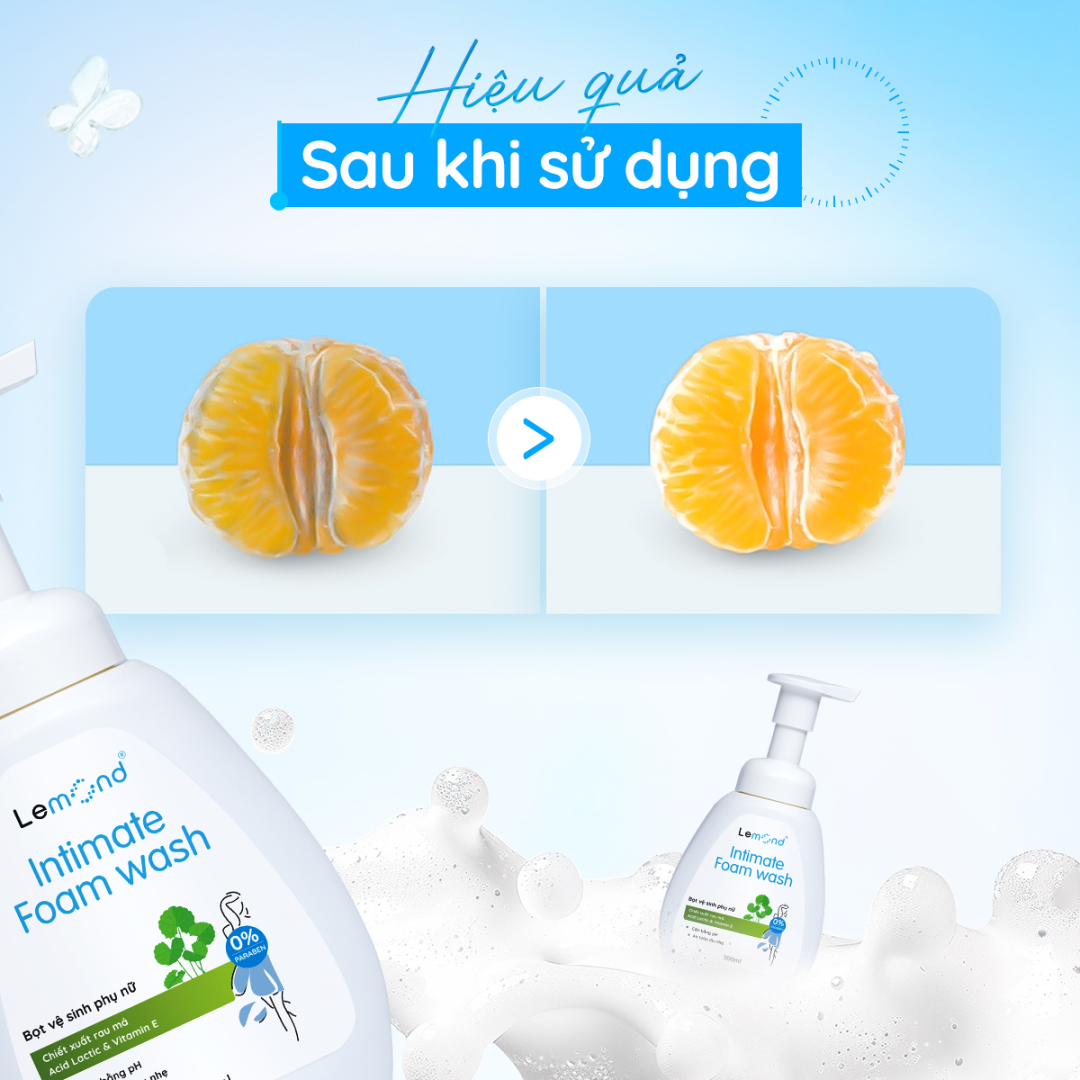 Bọt vệ sinh phụ nữ dịu nhẹ Lemond Intimte Foam Wash 300ml