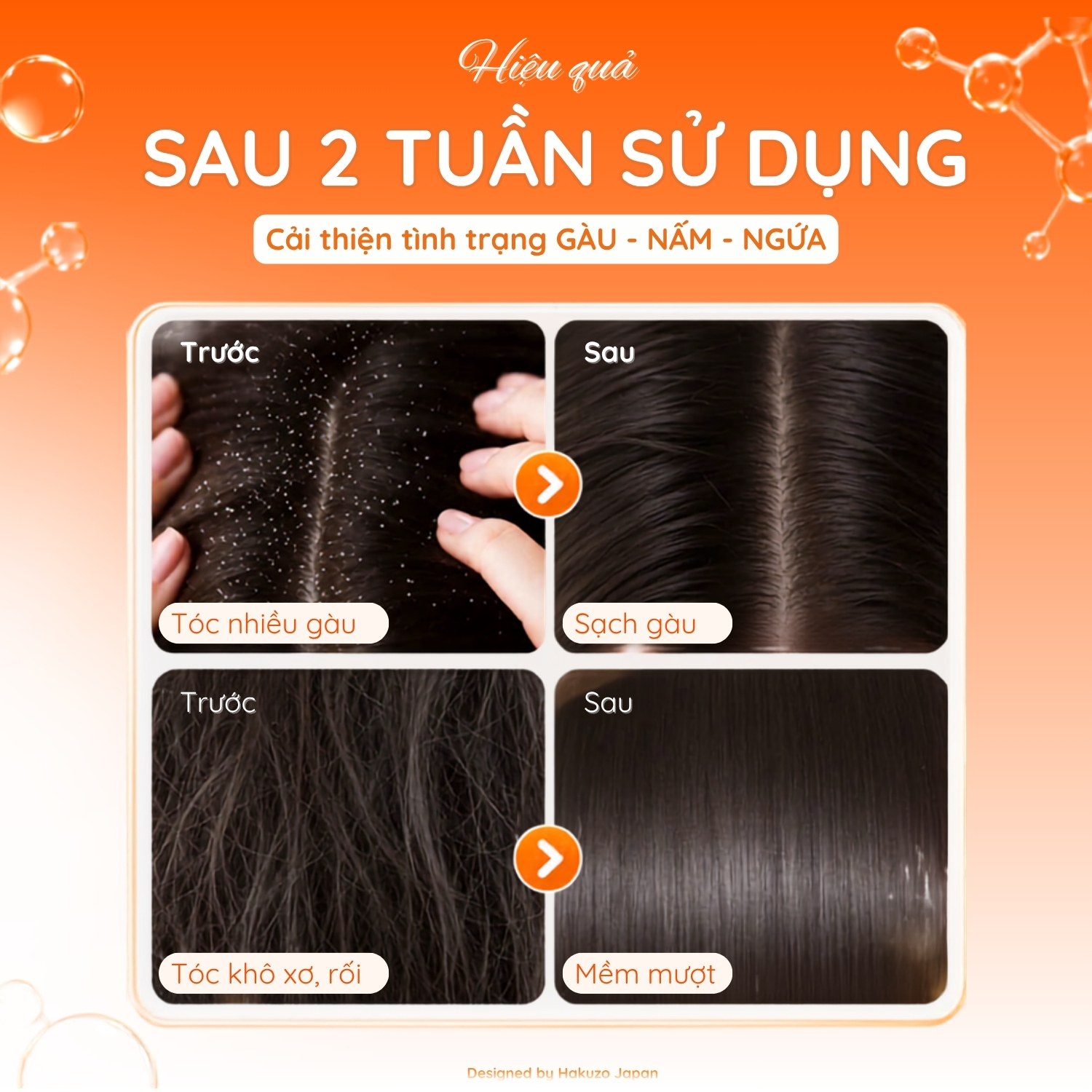 Dầu gội sạch gàu Lemond Antidandruff Shampoo 150ml